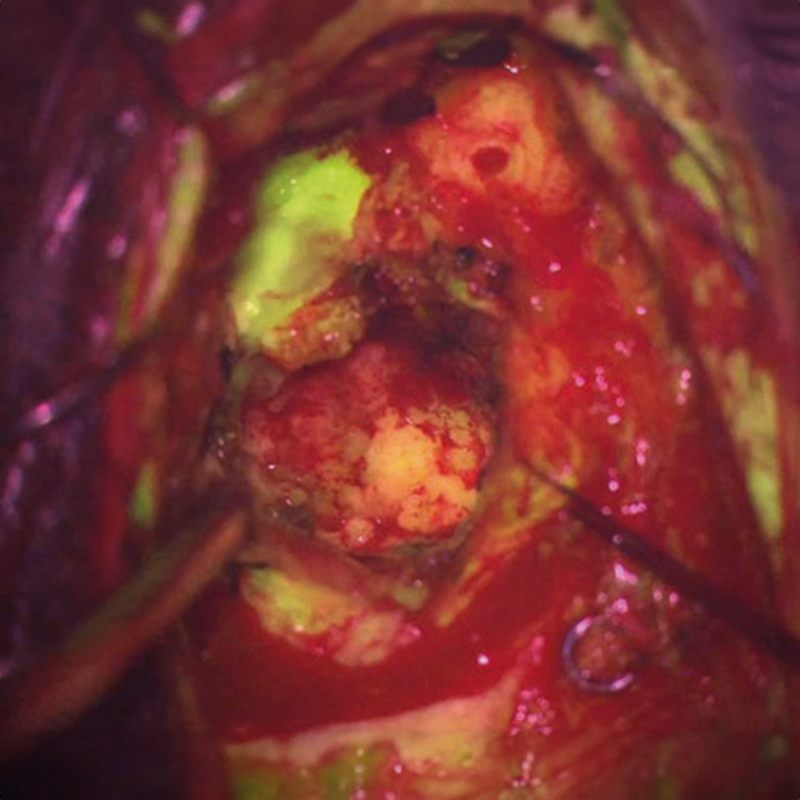 Операционная система для нейрохирургии ZEISS KINEVO 900